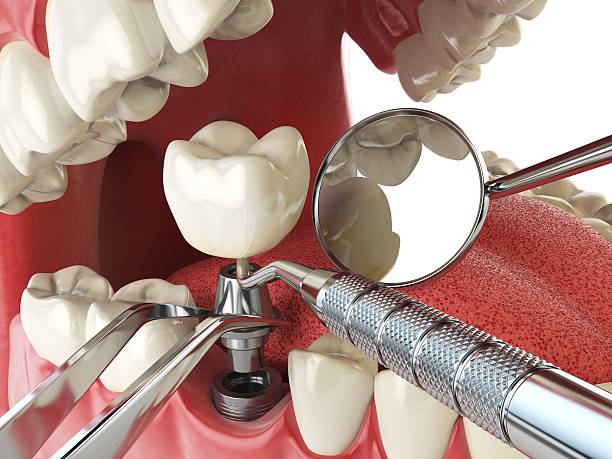 Best Weekend Emergency Dentist in Northlake, SC